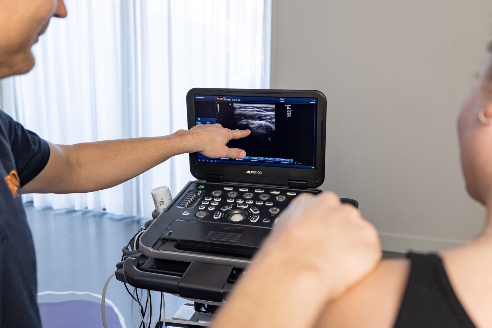 Echografie bij FYON