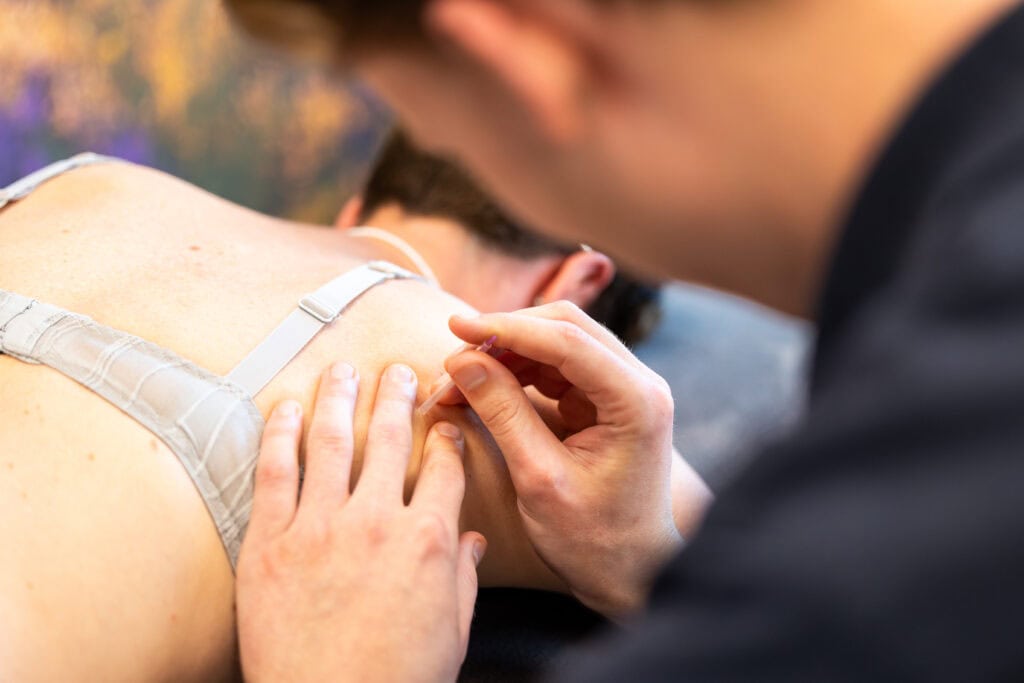 Dry Needling A26a2907 Verbeterd Nr