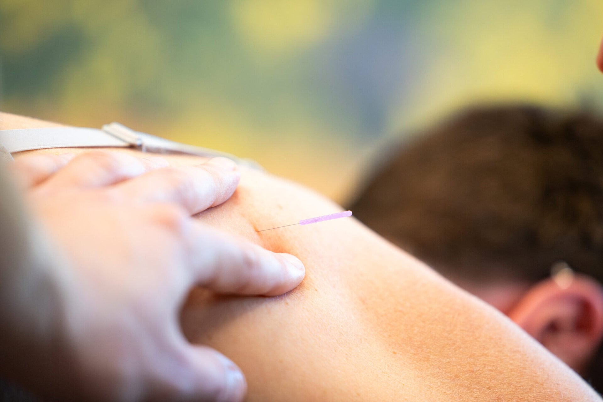 Dry Needling A26a2963 Verbeterd Nr